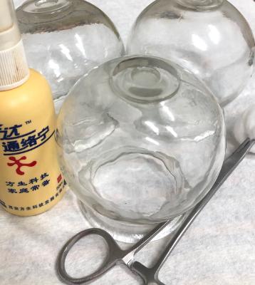 Cupping therapy session Cupping therapy session